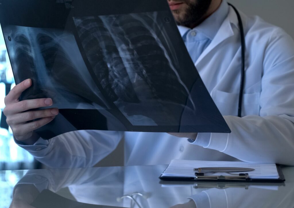 A doctor looking at an x-ray of a chest