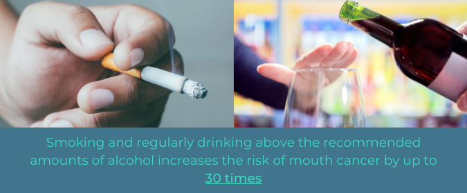 Smoking and regularly drinking above the recommended amount increase the risk of mouth cancer x 30