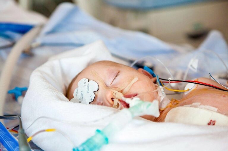 A Baby in intensive care