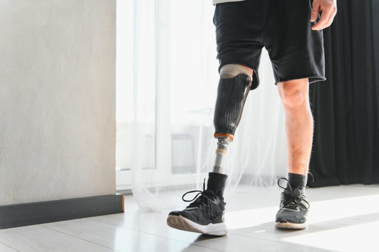 man with lower leg prosthesis